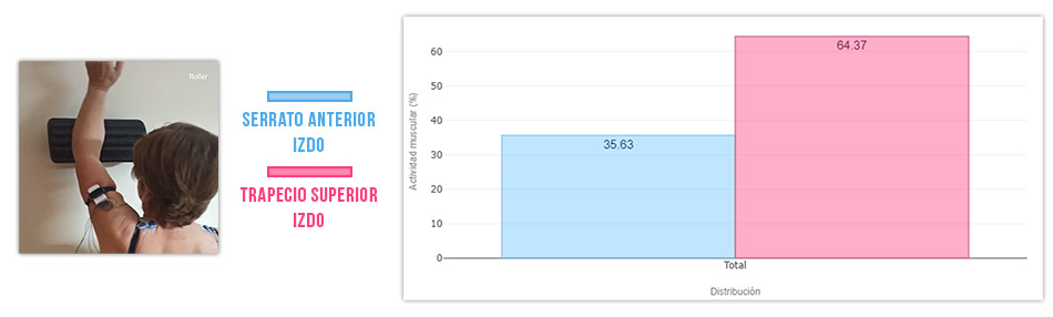 actividad serrato vs trapecio superior en cuadrupedia