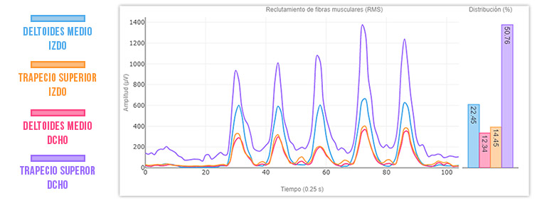 interpretación electromiografia (segundo paso para medir la evolución del paciente)