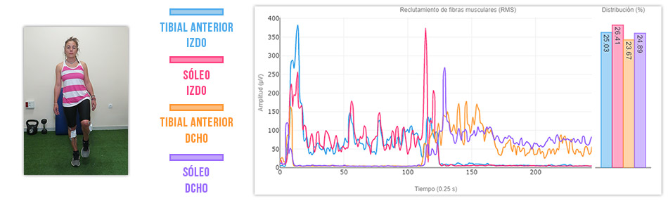 sinergia soleo - tibial anterior apoyo monopodal