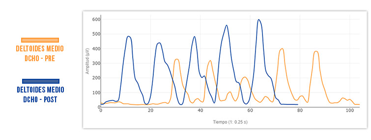 deltoides medio pre tratamiento vs post tratamiento