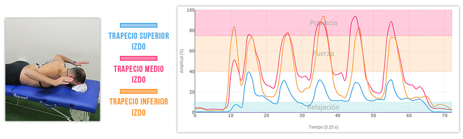 ejercicio para mejorar la estabilidad escapular - W en prono