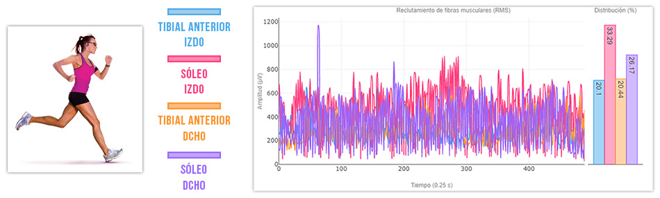 Sinergia soleo - tibial anterior al correr