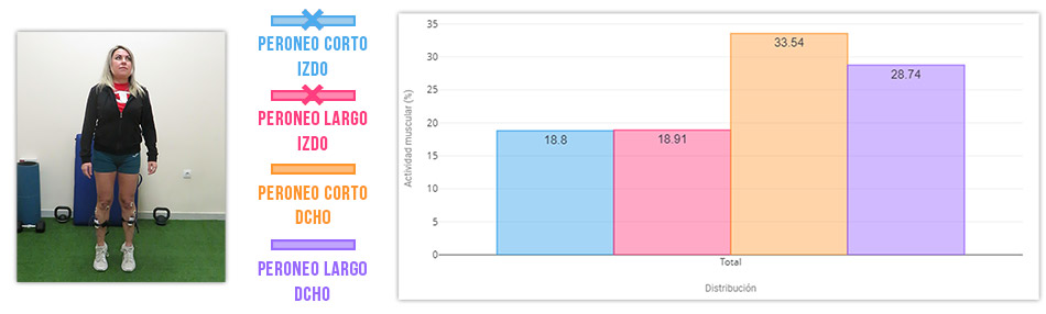 esguince de tobillo prueba puntillas bipodales