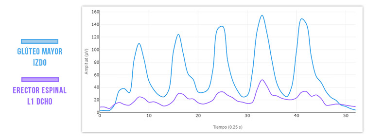 progreso puente de glúteo erectores vs glúteo 2 meses después