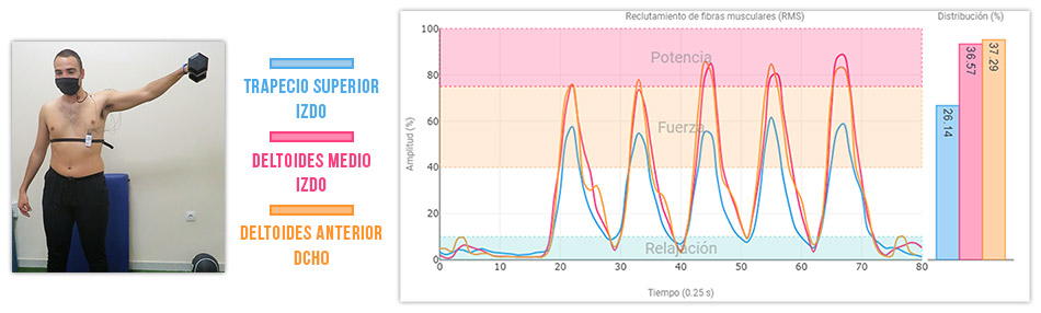 butterfly con mancuerna deltoides vs trapecio superior actividad muscular
