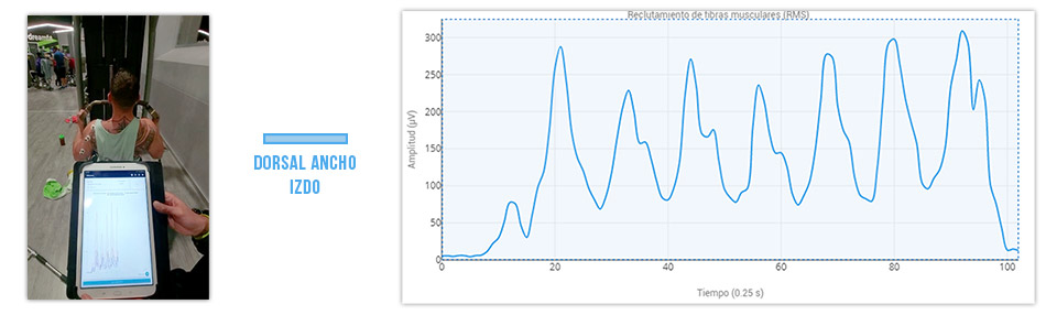 jalón al pecho sin biofeedback
