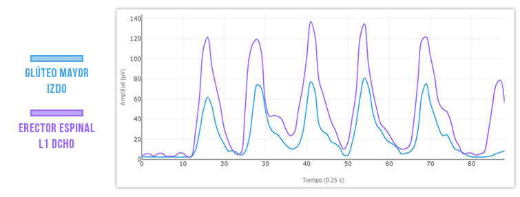 progreso puente de glúteo erectores vs glúteo