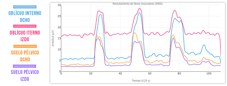 contracciones aisladas suelo pélvico