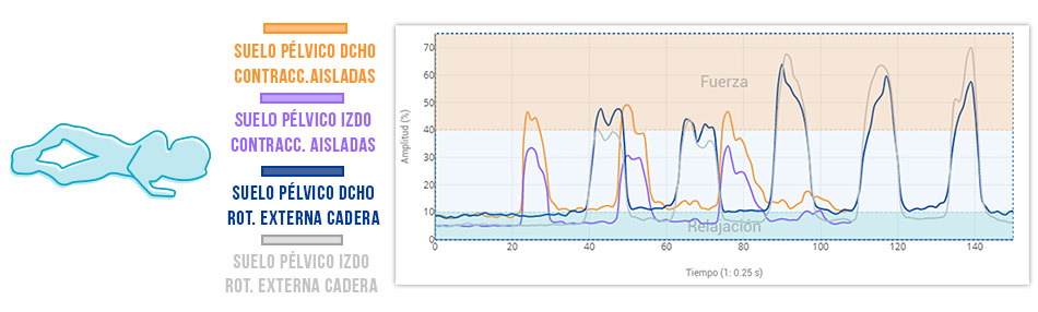 actividad muscular suelo pelvico contracciones aisladas + clamshell