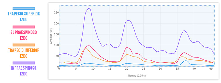 gráfico 1 rotación externa