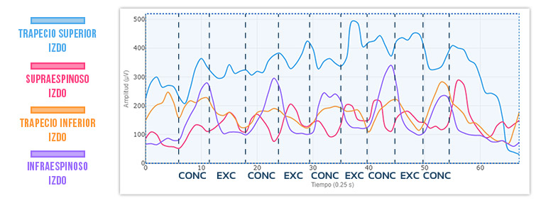 gráfico 4 rotación externa