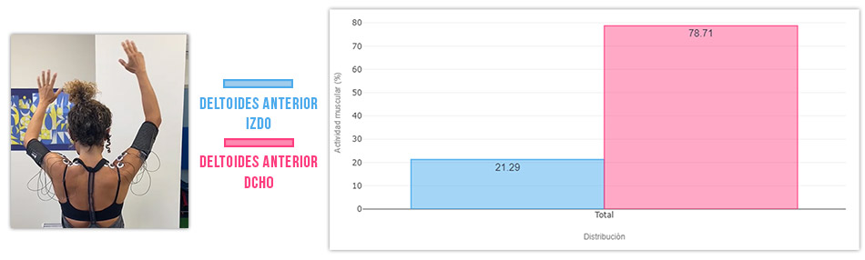 cómo medir un déficit de activación cruzando rango de movimiento