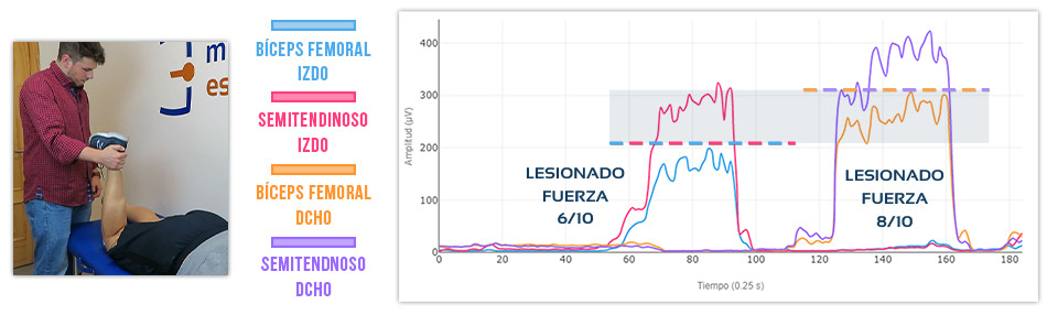 cómo cuantificar déficit de actividad muscular con datos de fuerza muscular
