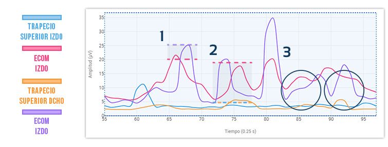 sinergia ECOM alterada