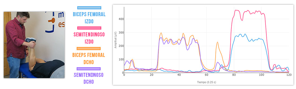 comparativa actividad muscular