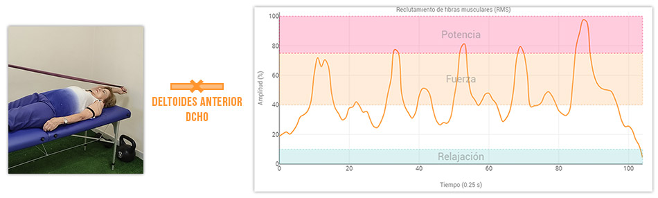 flexión de hombro en supino