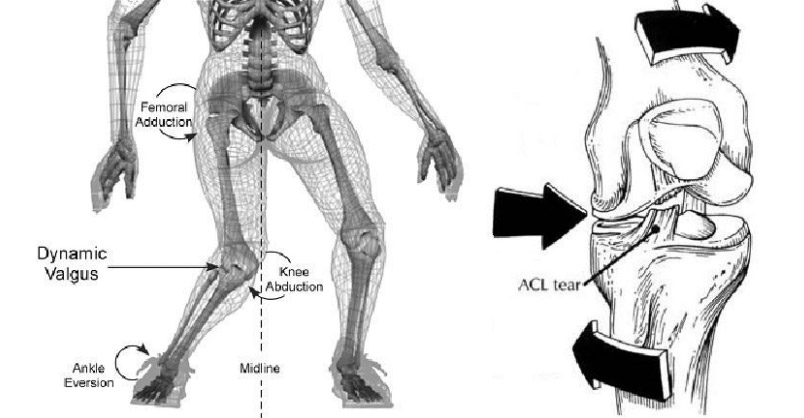 ligamento cruzado anterior