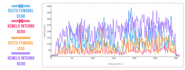 recto femoral y gemelo 