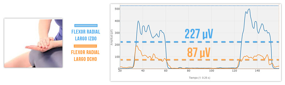 Flexión isométrica de muñeca.