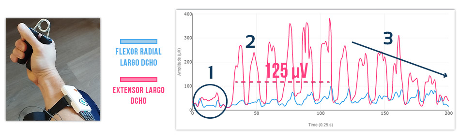 Agarre con hand-grip