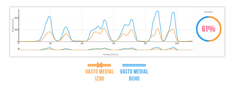 Simetría entre vastos mediales