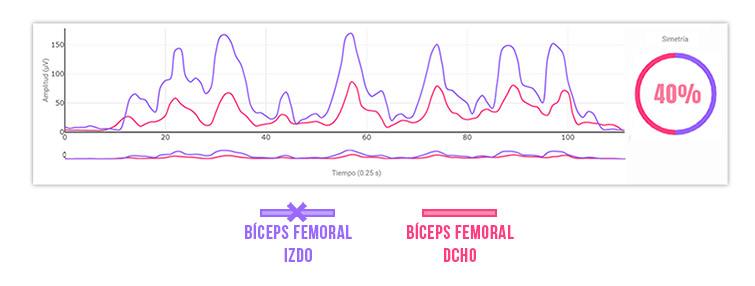 Simetría entre bíceps femorales