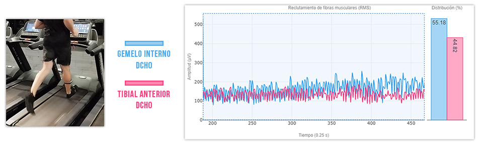 gemelo interno vs tibial anterior