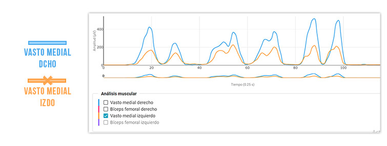 déficit de activación