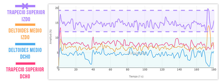 alteración del tono basal
