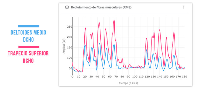 patrón sinérgico alterado
