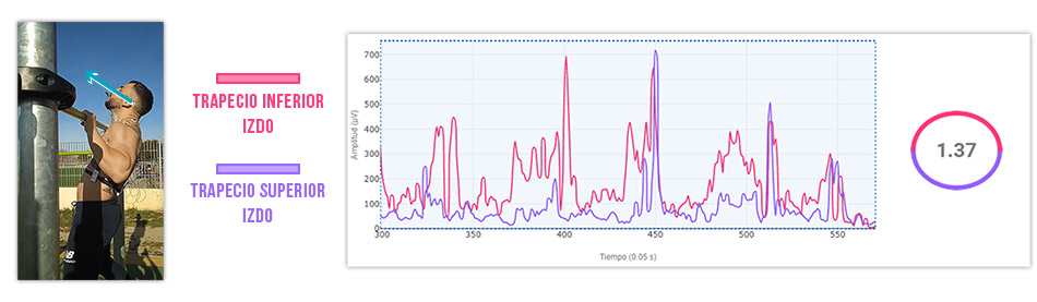trapecio superior e inferior