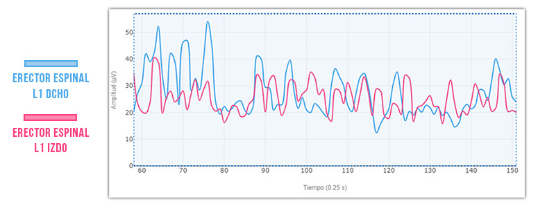 basal del erector espinal izquierdo