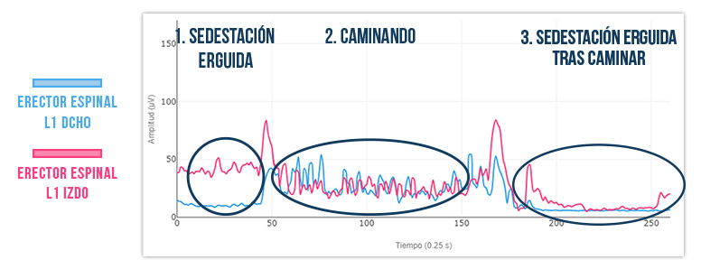 resultado de las pruebas de electromiografía