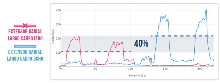 Test isométrico máximo con hand grip. Epicondilopatía