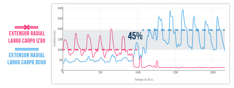 Test dinámico contra resistencia elástica