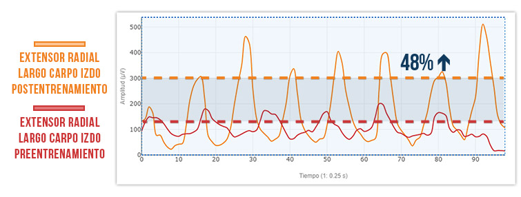 Test dinámico contra resistencia elástica