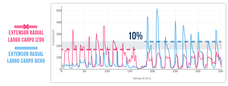 extensor radial del lado lesionado
