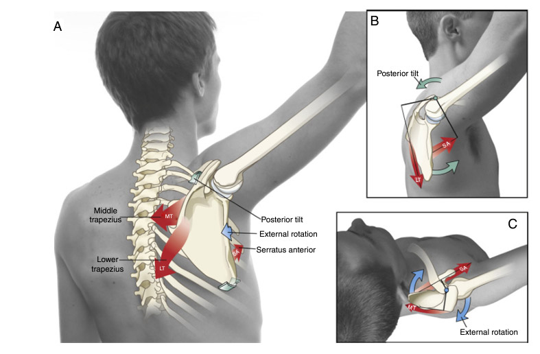 pinzamiento subacromial