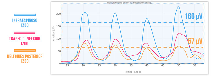 gráfica infraespinoso