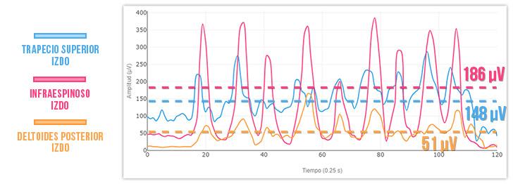 Band pull de rotación externa 1