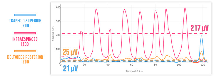 Band pull de rotación externa 2