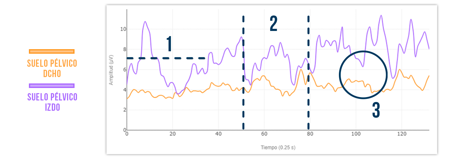 patrón motor alterado suelo pélvico