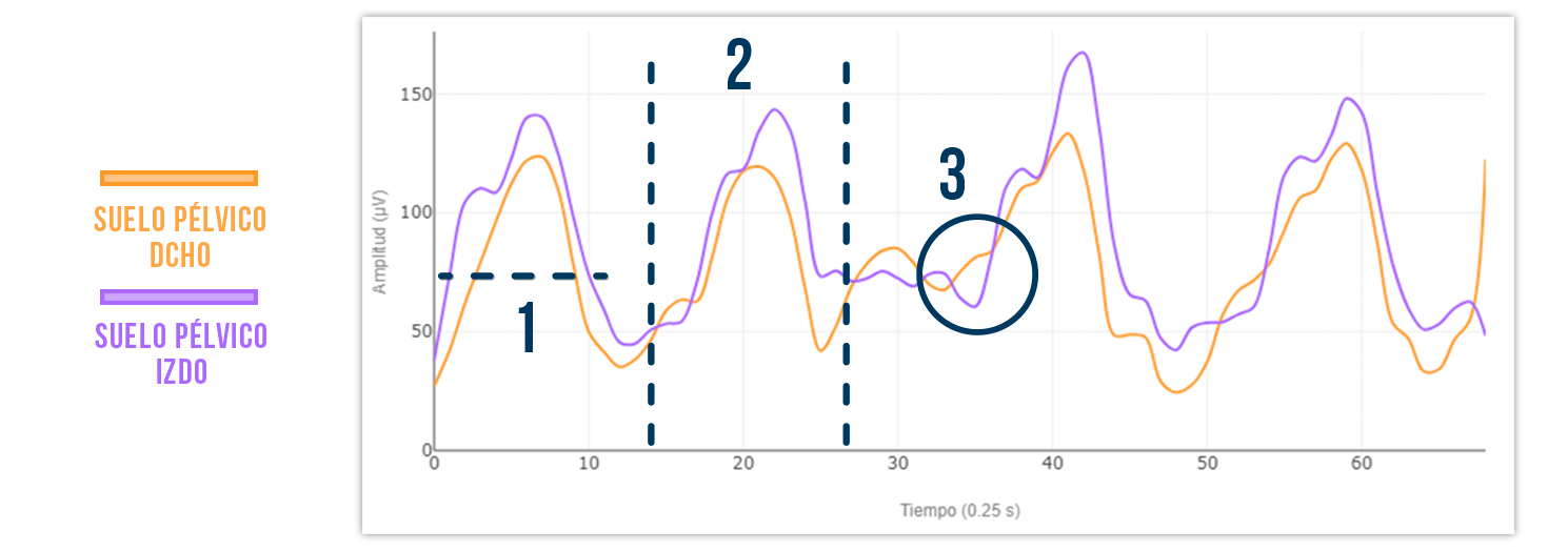 patrón muscular suelo pélvico correcto