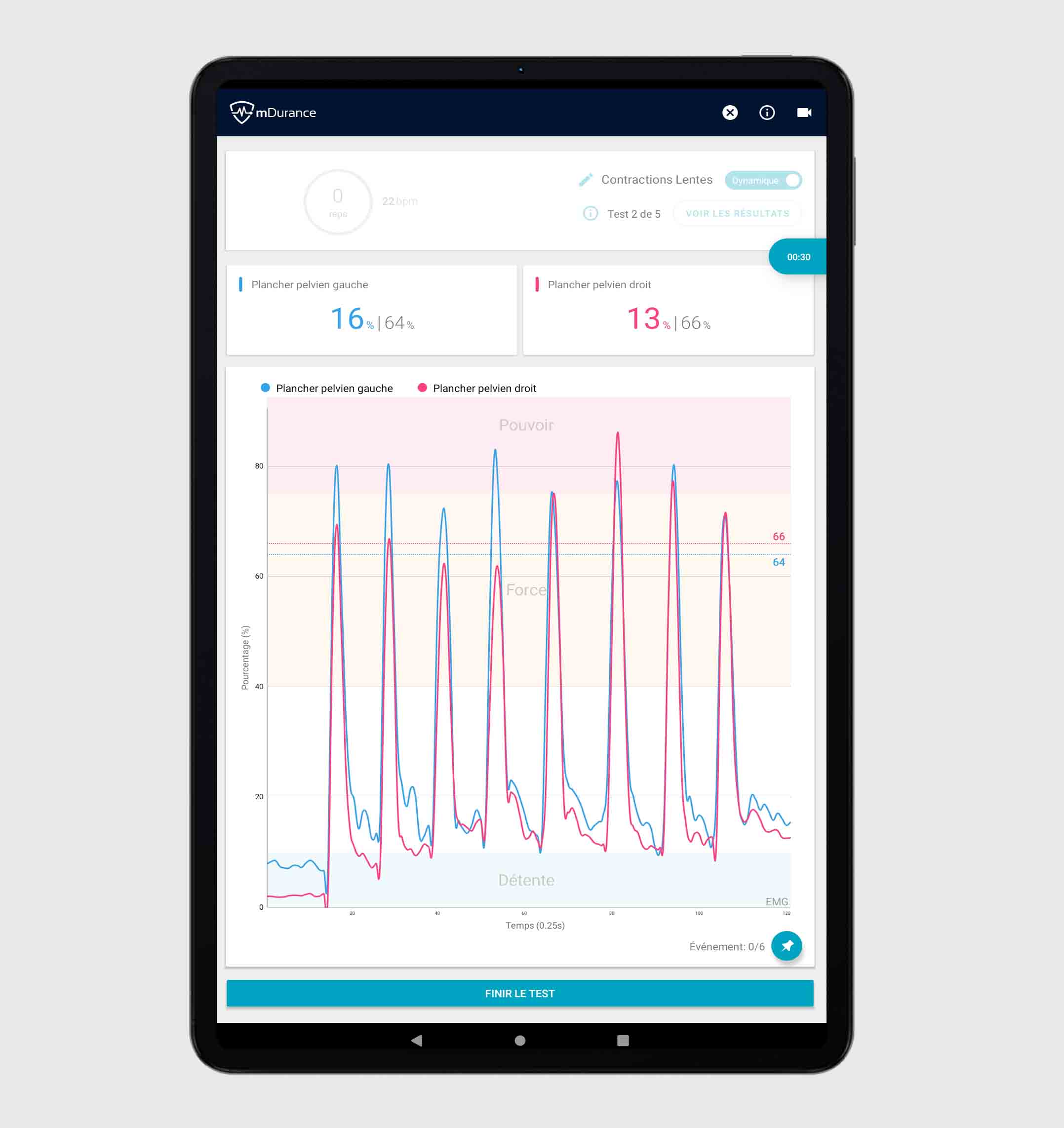 tablet 4 suelo pélvico_FR