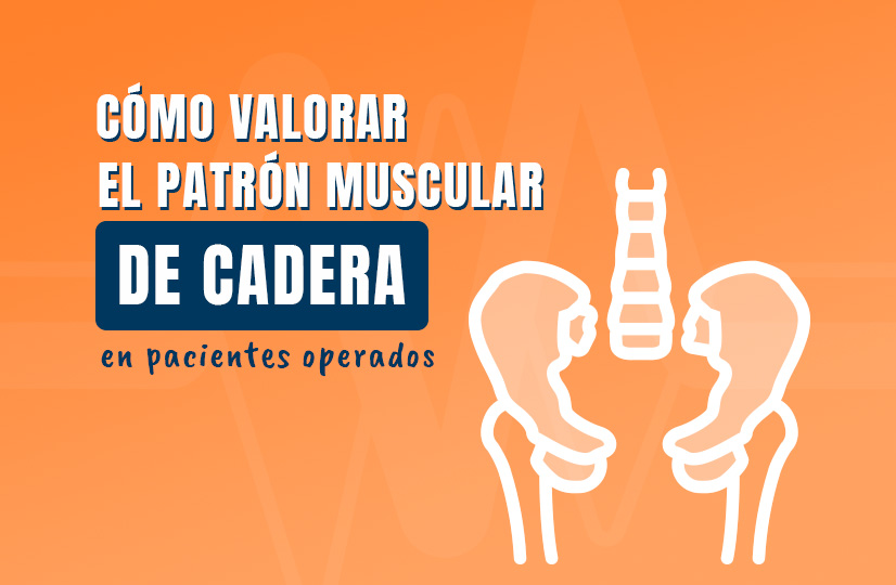 Cómo valorar el patrón muscular de la cadera en pacientes operados