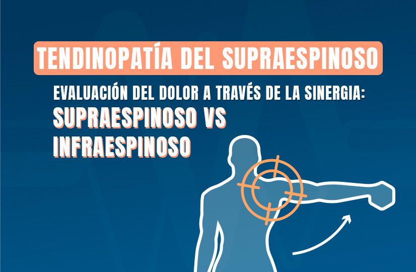 Tendinopatía del supraespinoso Evaluación del dolor a través de la sinergia supraespinoso vs infraespinoso