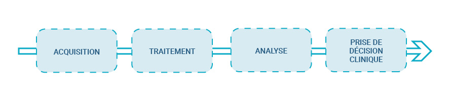 Traitement du signal EMG classique