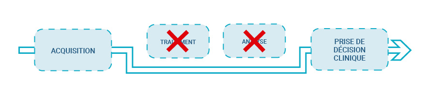 Traitement du signal EMG par mDurance