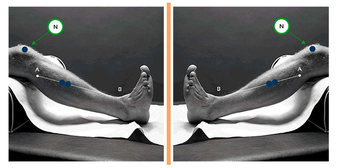 activación en la carrera