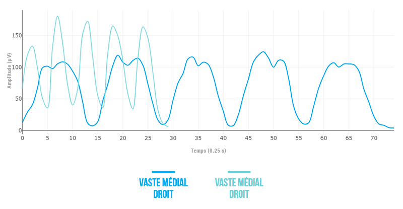 vaste láteral droit